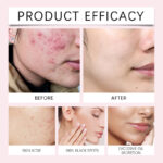 EELHOE Kojiczuur en kurkuma reinigingspads – Beauty