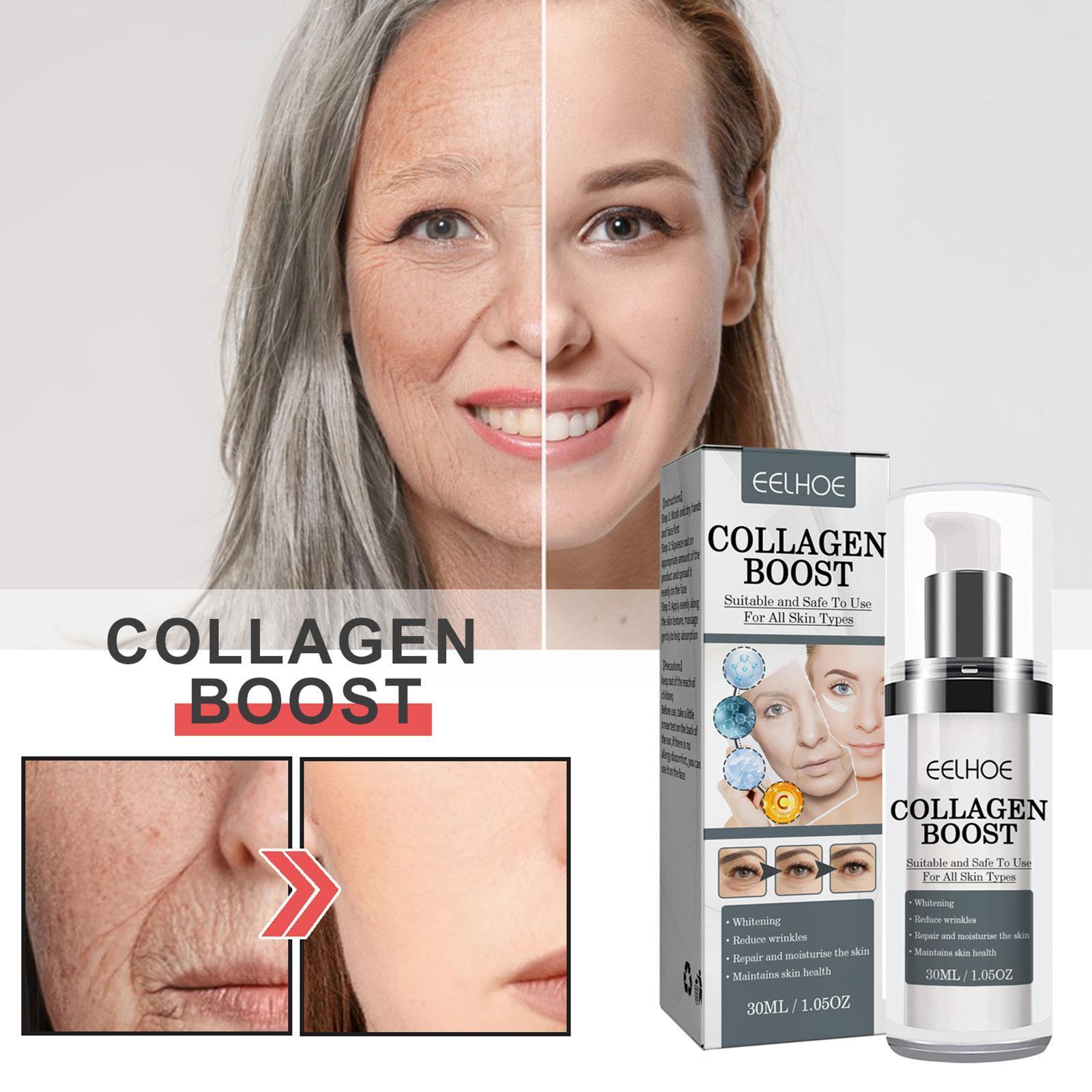Eelhoe Collagen Boost Anti-rimpelcrème verstevigt de huid Eelhoe Collagen Boost Anti-rimpelcrème verstevigt de huid