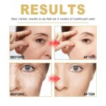 EELHOE Anti-rimpel gezichtsserum Liftend verstevigend Vervaag fijne lijntjes Anti-verouderingsessence